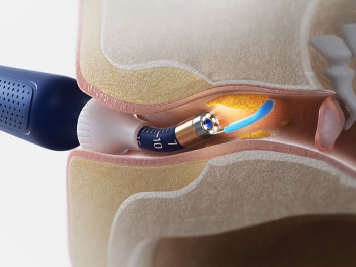 Wireless Ear Wax Removal Kits Cleaner with Camera